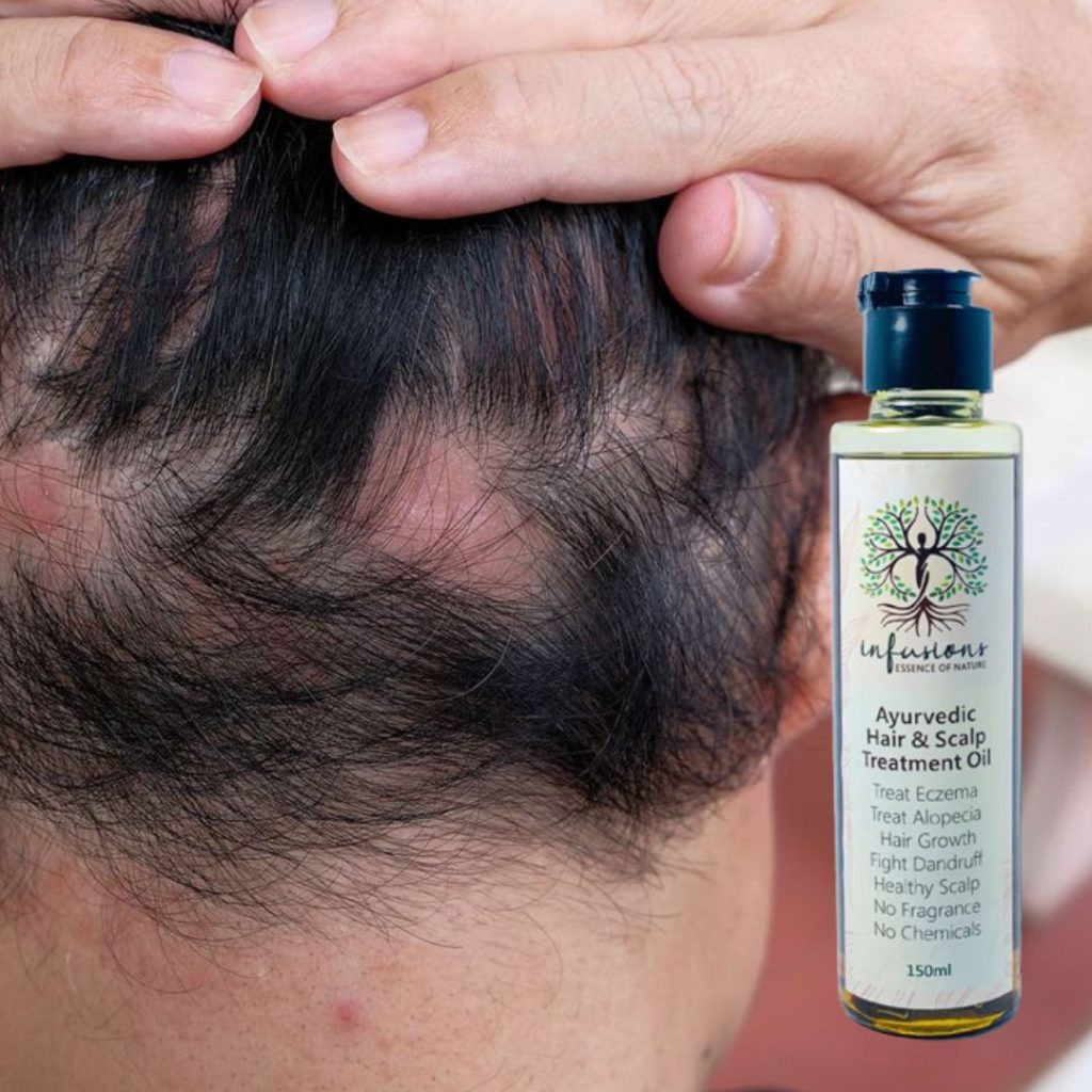 Hair & Scalp Treatment Oil